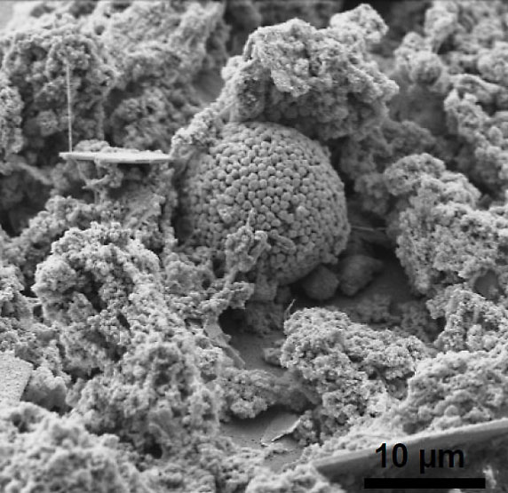 Image-In Situ Biological Treatment Figure 1-3